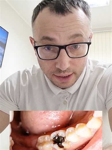 НАЙКРАЩА СТОМАТОЛОГІЯ у м.Суми ЛІКУВАННЯ ЗУБІВ #суми #сумистоматолог #сумистоматологія #стоматологсуми #стоматологіясуми