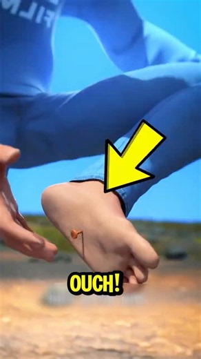 ⚠️ Stepped on a Rusty Nail? DON’T Make This Mistake!