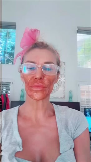 Angelo Landriscina, MD, FAAD on Instagram: "What are “delusions of parasitosis?”"