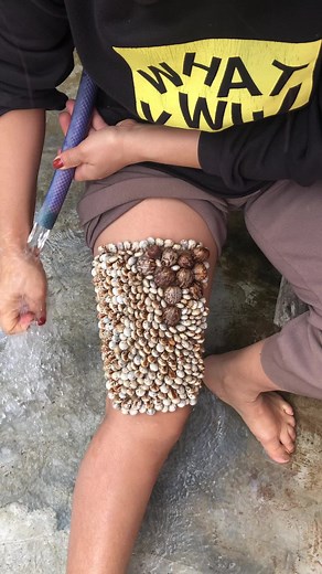 Effective Methods to Remove Ticks from Skin