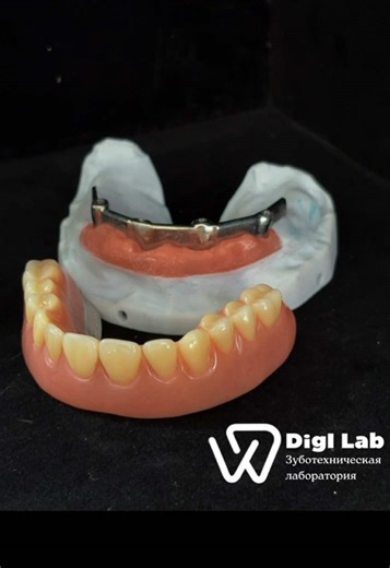 #стоматология #рекомендации #Digilab #зубнойтехник #зуботехническаялаборатория