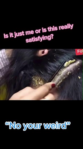 Am I the only one? #asmr #psoriasis #popping