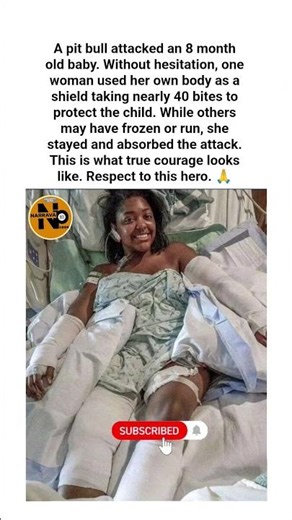 She Took Nearly 40 Pit Bull Bites to Save an 8-Month-Old Baby 🛡️❤️#Cher #ComebackStory #WomenWhoWin