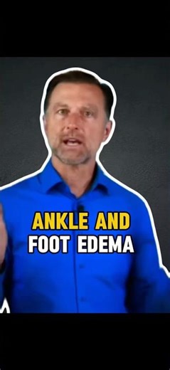 Ankle and Foot Edema: What Pitting Edema Reveals About Your Circulation