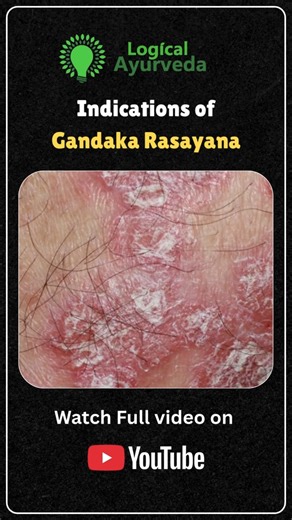 Indications of Gandaka Rasayana #ayurveda #bams #reelsinstagram😍#ᴛʀᴇɴᴅɪɴɢʀᴇᴇʟs | Logical Ayurveda