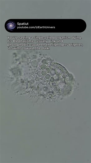 Blepharisma Dying Under the Microscope (Photophobic Protist)