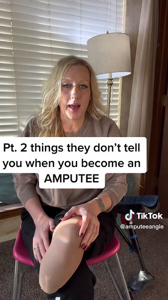 Navigating Life as an Amputee: Tips and Challenges Revealed