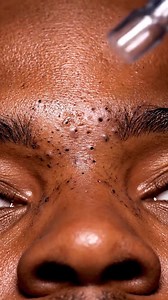 “From Fully Congested to Perfectly Clean in One Pass—Macro ASMR Magic!” | Listingpeal