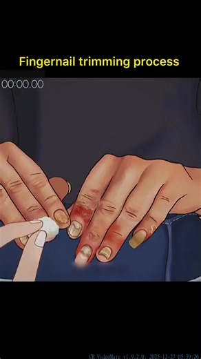 Effective Teeth Cleaning Process for Optimal Dental Health