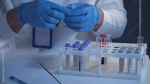 Pathologist working in lab with blood samples. Scientist processing DNA sample in laboratory. Healthcare, blood examination, research of blood. Laboratory worker preparing slide with blood samples.