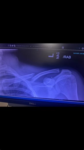 and just like that your life is changed #longlivelevimartin🕊 #honda