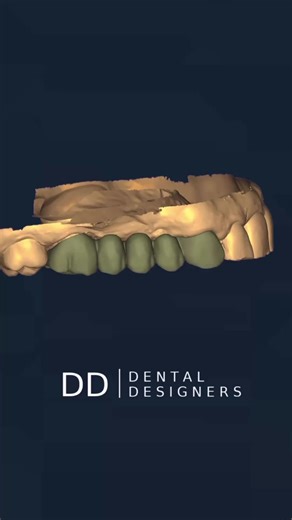Dental Bridge Solutions: High-Quality Design Services