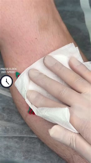 The Most TOP view of 2025 trippy cat 🐈‍⬛ . . #trippycat #seoultattoo #tattooartist | Yoonneedle