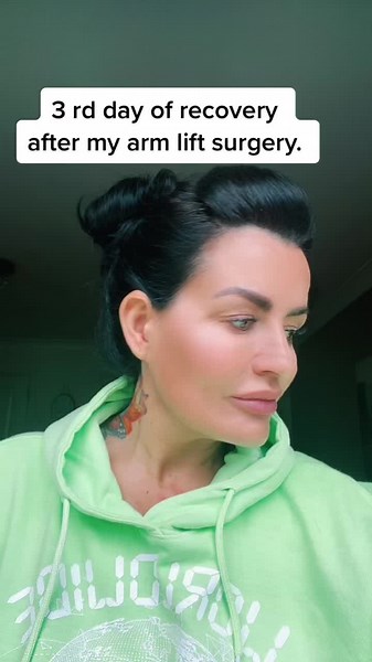 Navigating Recovery: Arm Lift Surgery Journey