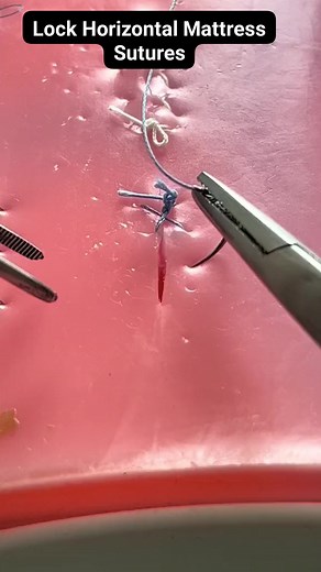 Lock Horizontal Mattress Sutures | MF HealthCare