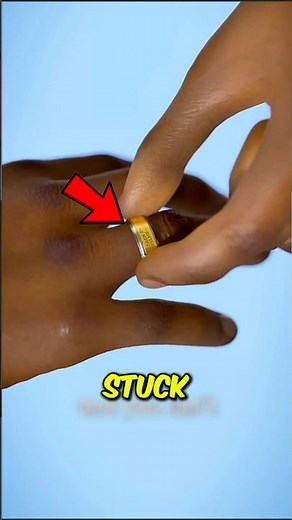 Stuck Ring Emergency? Here's How to Get It Off Without Hurting Yourself 😱💍