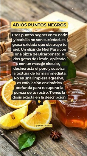 ¿PUNTOS NEGROS? 👃 Remedio para Limpiar tus Poros al Instante