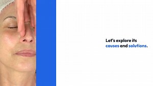 Natural Solutions for Cellulite