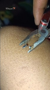 Mosquito hunter🦟 | Cristen Atibagos Masenas