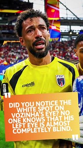 Vozinha’s Left Eye Blindness Revealed During World Cup Moment