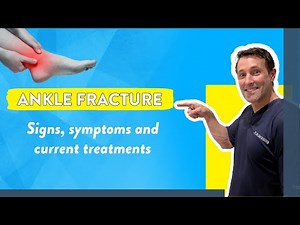 Ankle fracture: Signs, symptoms and current treatments