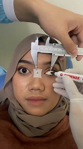 426K views · 536 reactions | Ever wondered how a prosthetic eye gets fitted?  | Tyla | Facebook