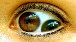10 People with the Most Unusual Eyes – Eye-Catching Features