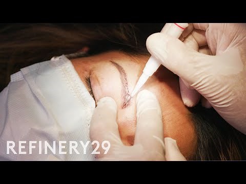 I Got An Eyebrow Hair Transplant After Alopecia | Macro Beauty | Refinery29