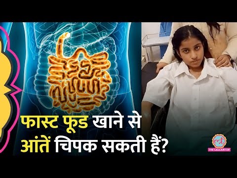 Amroha में ज़्यादा Fast Food खाने से गई 16 साल की लड़की जान, AIIMS में भर्ती थी