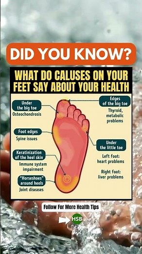 What Your Foot Calluses Say About Your Health