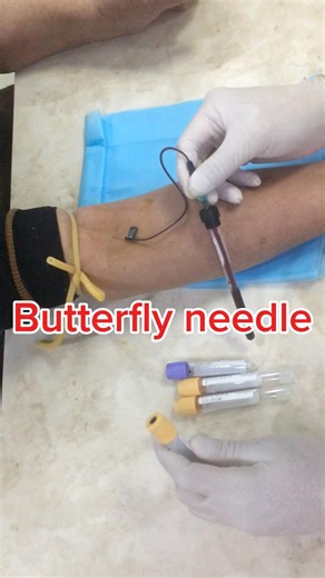 Butterfly needle #phlebotomy #phlebotomist #blutentnahme #coletadesangue #採血