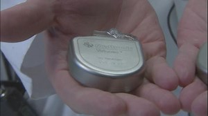 New, less-invasive cardiac device helps Triangle patients