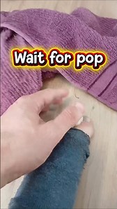 The most dramatic Pimple Pop ever (look at my sock) #shorts #oddlysatisfying #pimple