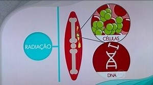 Excesso de exames com radiação pode até provocar câncer