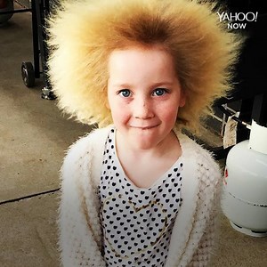 Shilah has a rare genetic disorder that makes her hair "uncombable" — and she's embracing it 💁‍♀️ | In The Know Now