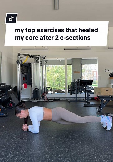 Top Ab Exercises for Healing Core After C-Sections