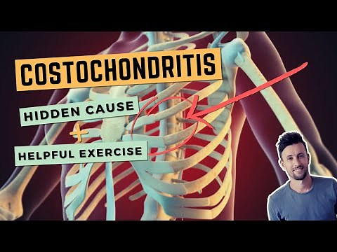 Costochondritis: The Hidden Cause and a Simple Exercise to Fix Anterior Rib Joint Pain
