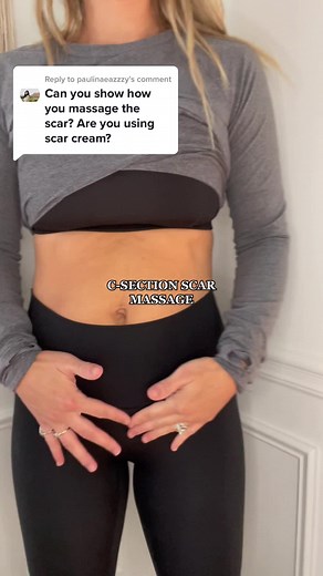C-Section Scar Massage: Tips for Recovery and Reduction