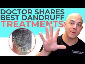 How to Treat Dandruff—Expert Tips