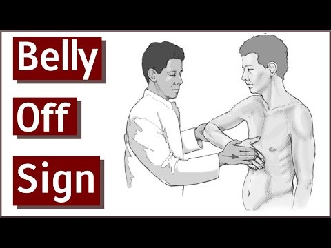 Belly Off Sign | Subscapularis & Rotator Cuff