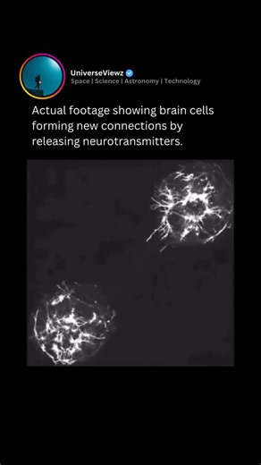 Space | Science | Astronomy | Technology on Instagram: "When a neuron is activated, it sends an electrical signal down its axon, leading to the release of neurotransmitters into the synaptic gap. These molecules then bind to receptors on the adjacent neuron, triggering a response that continues the signal transmission. [ 📹 Small World In Motion ] Over time, repeated communication can lead to the strengthening of these synaptic connections, a process known as synaptic plasticity. This is crucial