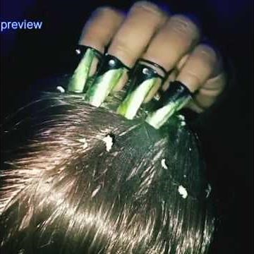 #dandruffscratching Satisfying Dandruff Scratching ASMR 😴 | Crunchy Scalp Flake Sounds #asmr