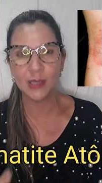 Para que serve o Cetoconazol + dipropionato de betametasona + sulfato de neomicina #dica #shorts