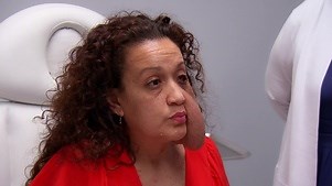 Botched: Season 8 Episode 20 Tumor Tragedy