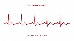 Download animated normal sinus rhythm. animated ekg display for free