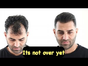 THICK FIBER l Hair Loss Powder for Thinning & Balding Hair