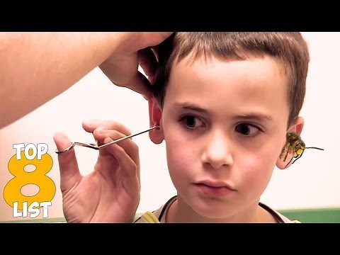 Top 8 Weird Things Found in Peoples Ears - Thelistbomb