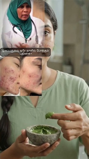 😍 Pimples Gone? Try This Mint Leaf Paste for Glowing Skin #naturaltips