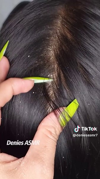 Scalp Mic ASMR: Long Nails for Ultimate Relaxation