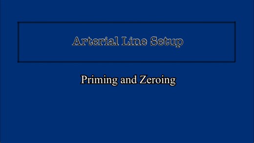 پرایم کردن خط شریانی با استفاده از ادواردز تروویو